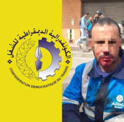 المكتب الوطني لعمال وعاملات النظافة يستنكر الاعتداء على عامل نظافة بسوق الربيع بمراكش