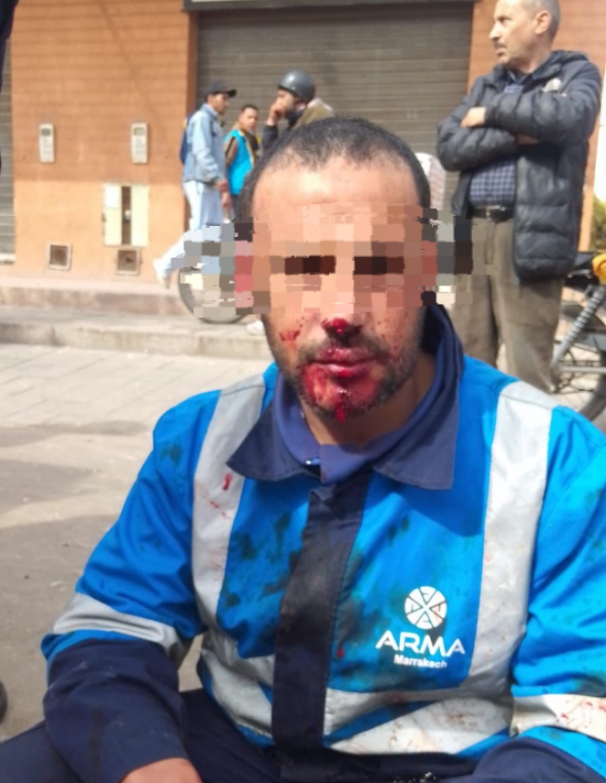 مراكش: اعتداء دامي بسوق "الربيع" يرسل عامل نظافة إلى مستعجلات المستشفى الجامعي