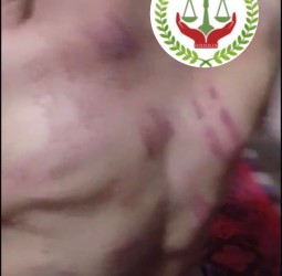 منظمة حقوقية تدخل على خط تعذيب طفل بتسلطانت وتدعو لفتح تحقيق قضائي بمراكش