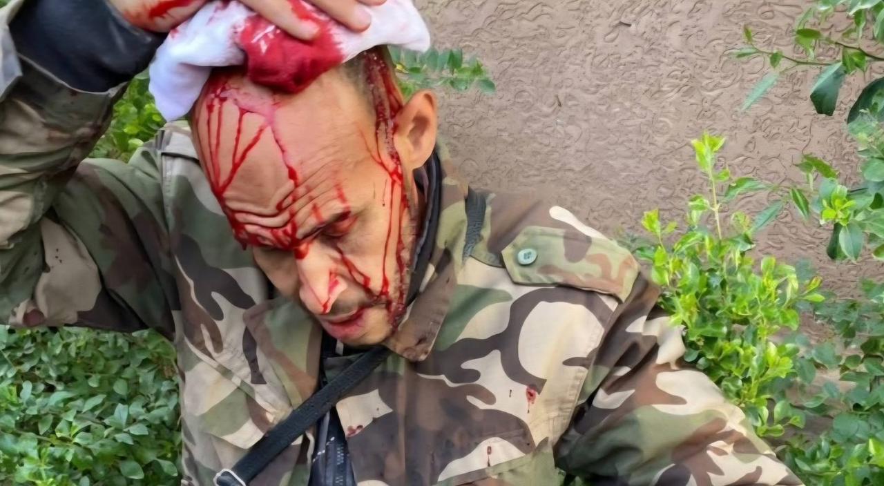 هجوم عنيف على تاجر بسوق الدراجات المستعملة بسيدي يوسف بن علي