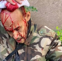 هجوم عنيف على تاجر بسوق الدراجات المستعملة بسيدي يوسف بن علي