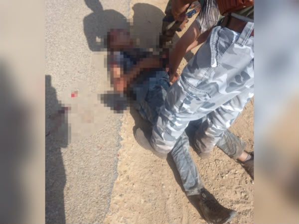 رصاصة طائشة خلال رحلة صيد تنقل شخصاً إلى المستعجلات في حالة حرجة
